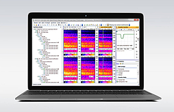 Screen with Prognoise